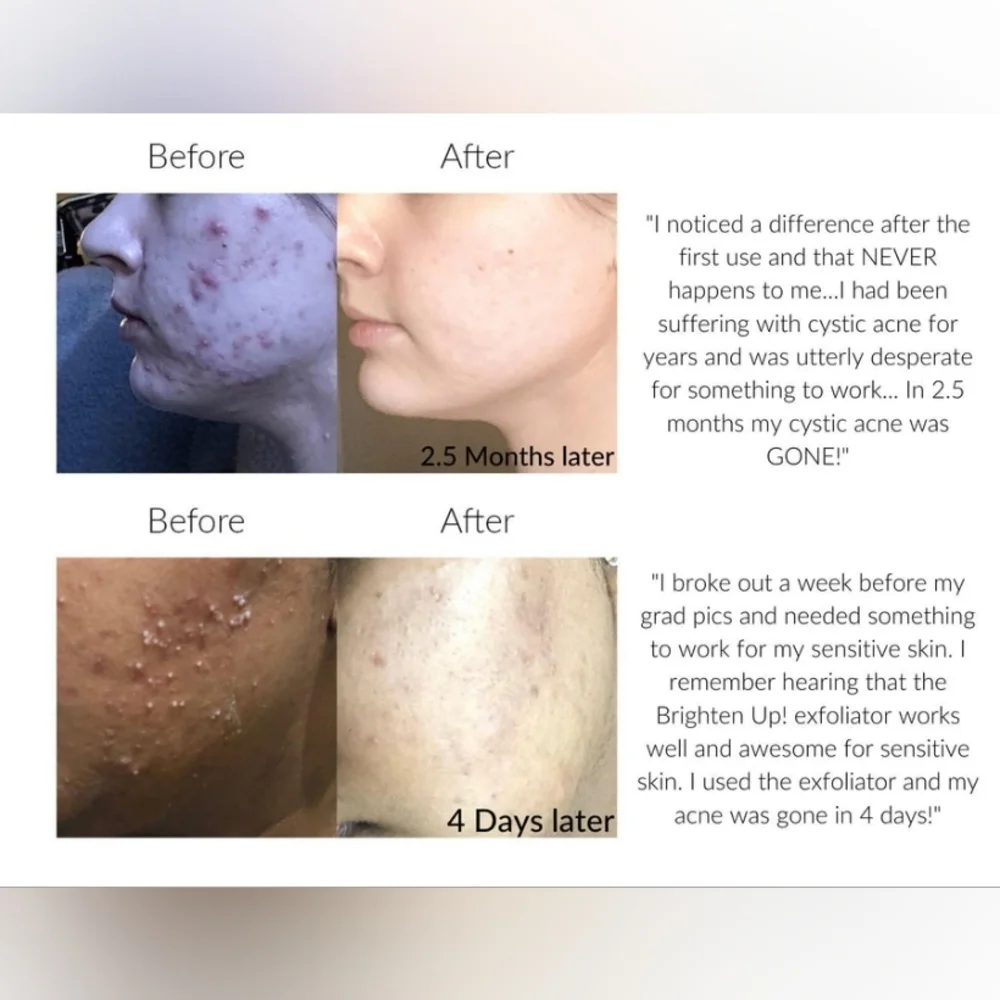 Vasanti Brighten Up! Exfoliator (Enzymatic Face Rejuvenator)